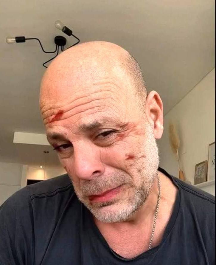 Bruce Willis’ wife Emma Heming shares heartbreaking video of him after his dementia diagnosis