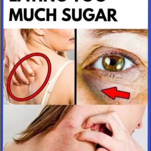 12 Signs You’re Eating Too Much Sugar!