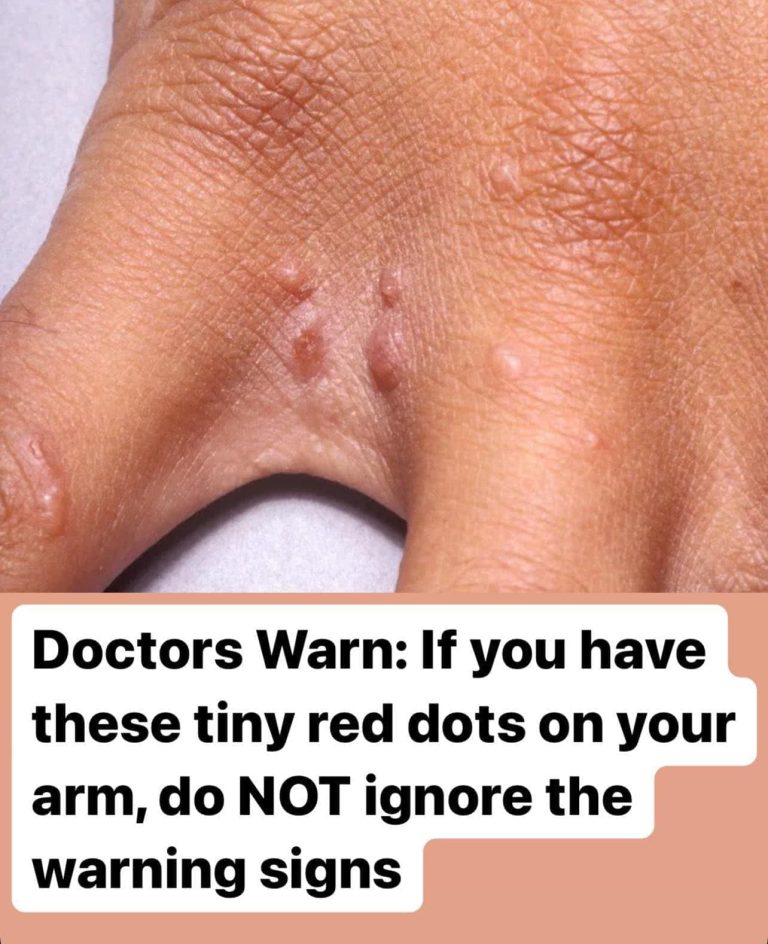 “Don’t Ignore These Tiny Red Dots on Your Arm – They Could Be Warning Signs”