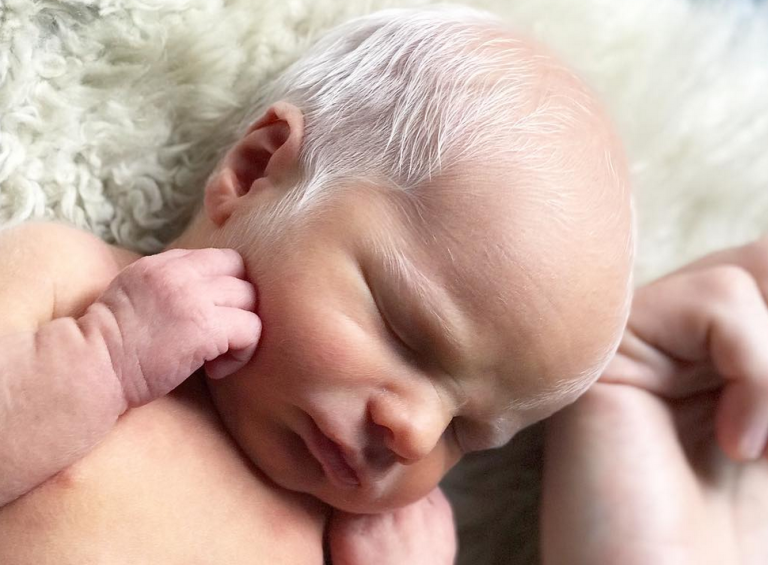 Baby mocked for having white hair – years later, he looks perfectly happy and healthy.