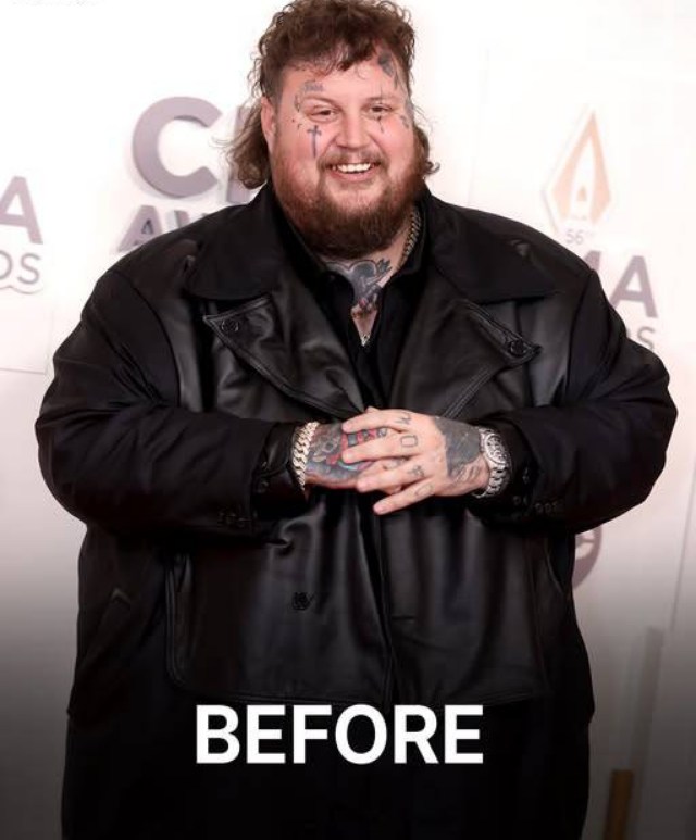 Jelly Roll Shares 100-Pound Weight Loss Transformation