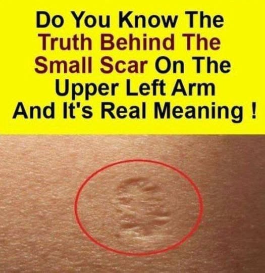 Do you know the true meaning of the little scar?