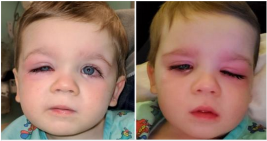 Mom issues warning after toddler nearly lost eyesight from bath toy