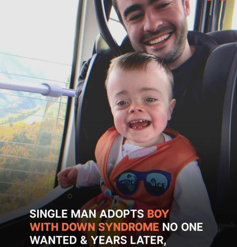 Single Dad Adopts Boy with Down Syndrome No One Wanted, Years Later Learns of Kid’s Inheritance – Story of the Day