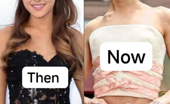 OH NO! What’s Happening to ARIANA GRANDE? Is she SUFFERING an illness? Why DOES she LOOK LIKE THAT NOW!