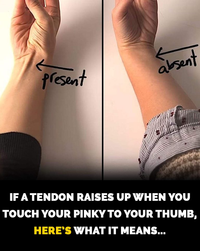 How to check if you’ve lost this tendon on your arm to evolution