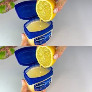 Mix Vaseline with Lemon and you will be shocked!