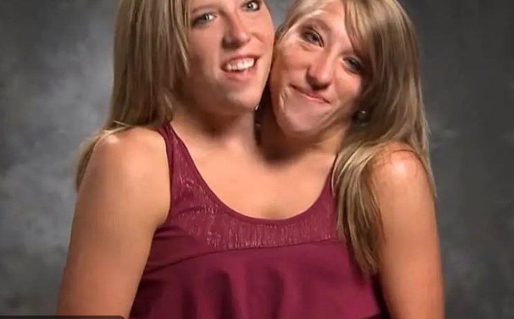 Abby and Brittany Hensel: The world’s most famous conjoined twins are now 5th grade teachers (VIDEO)