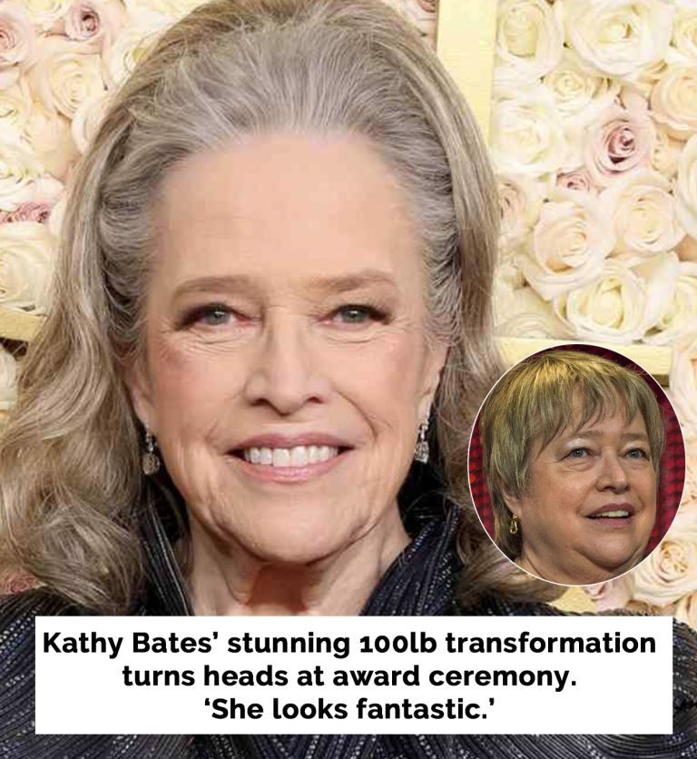 Kathy Bates stuns with new look at Golden Globes