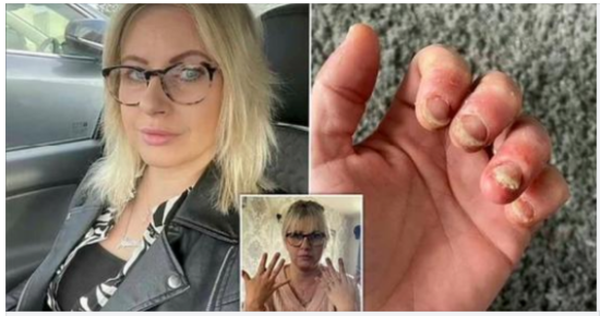 ‘I’ve got my nails done my entire life – but now I can barely use my hands’