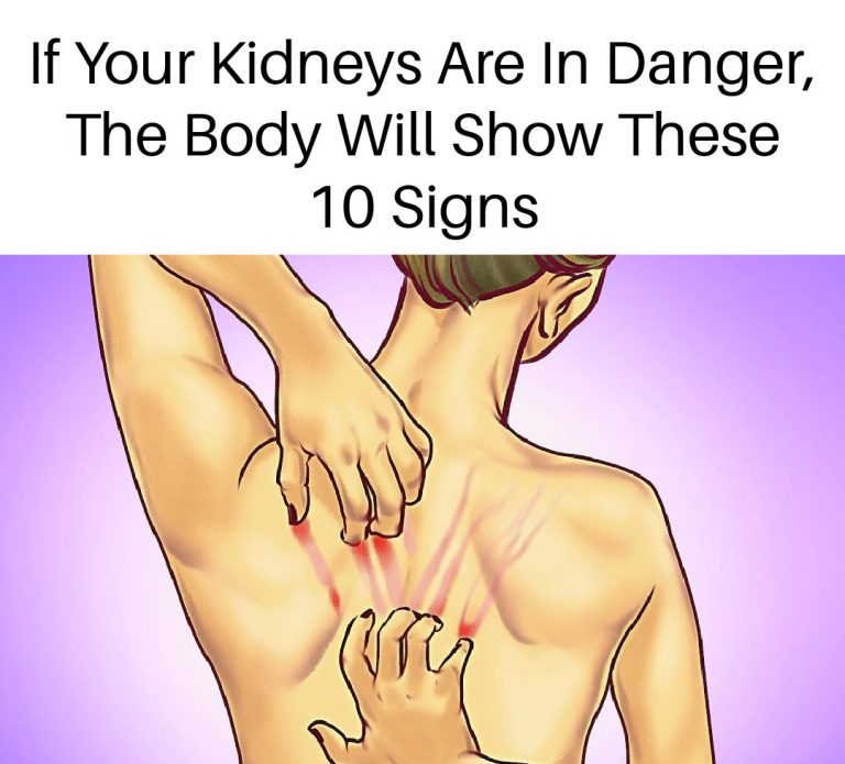 If Your Kidneys Are in Danger, the Body Will Show these 10 Signs #280