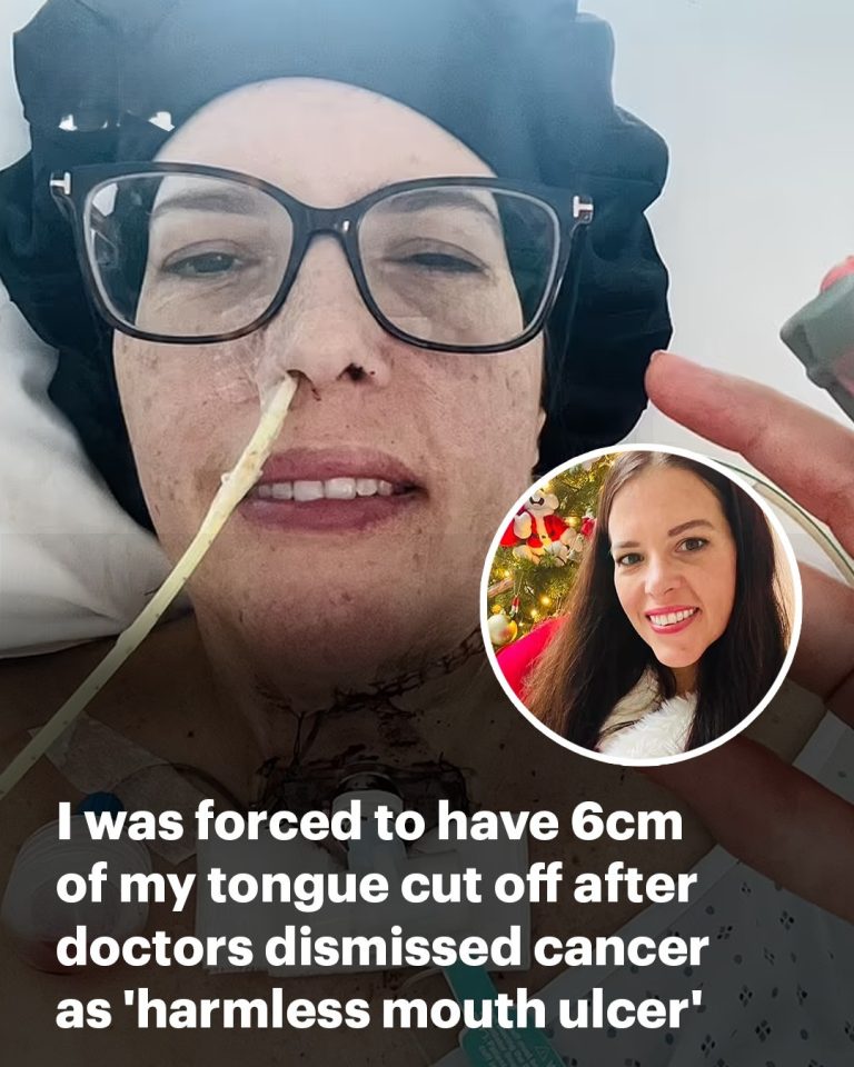 EXCLUSIVE I was forced to have 6cm of my tongue CUT OFF after doctors misdiagnosed cancer for a ‘harmless mouth ulcer’