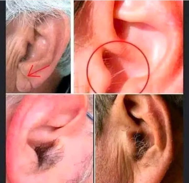 Did you know that if your ear hairs grow, it is because your body is