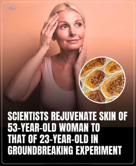 In A Groundbreaking Experiment, Scientists Rejuvenate A 53-Year-Old Woman’s Skin To That Of A 23-Year-Old