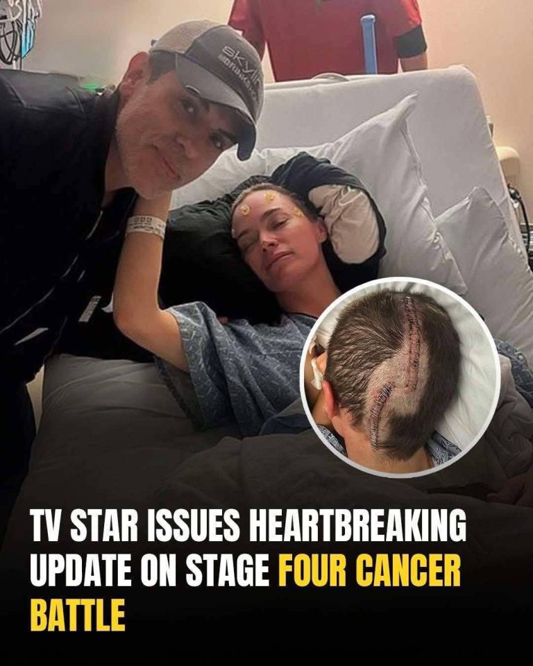 Teddi Mellencamp talks about battling stage 4 melanoma