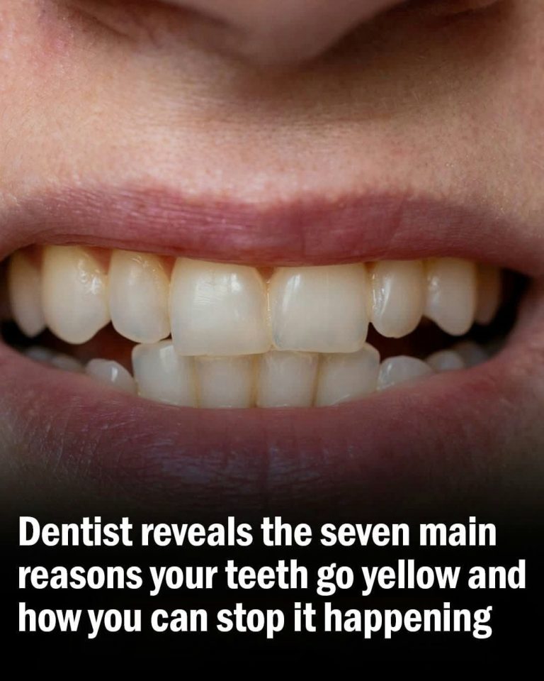 10 Simple Remedies to Help Relieve Gum Disease At Home