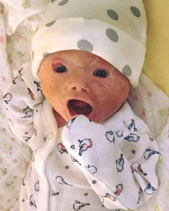 Mom shocked by her baby after birth, her words now spread like forest fire!