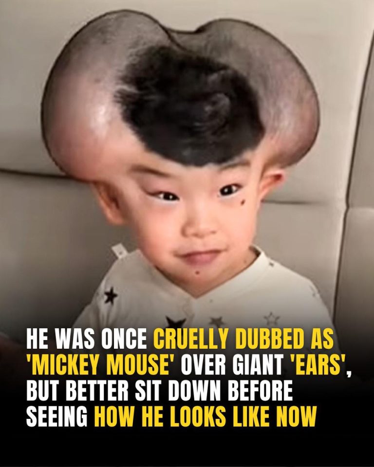 Boy once mocked and called “Mickey Mouse” – see him today