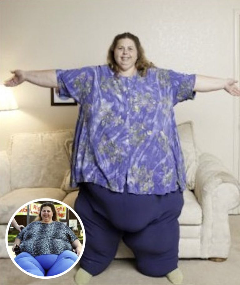 People Stunned After ‘World’s Heaviest Woman’ Loses 500+ lbs – Here’s What She Looks Like Now