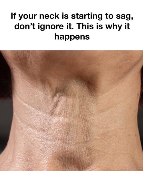 If your neck is starting to sag, don’t ignore it. This is why it happens