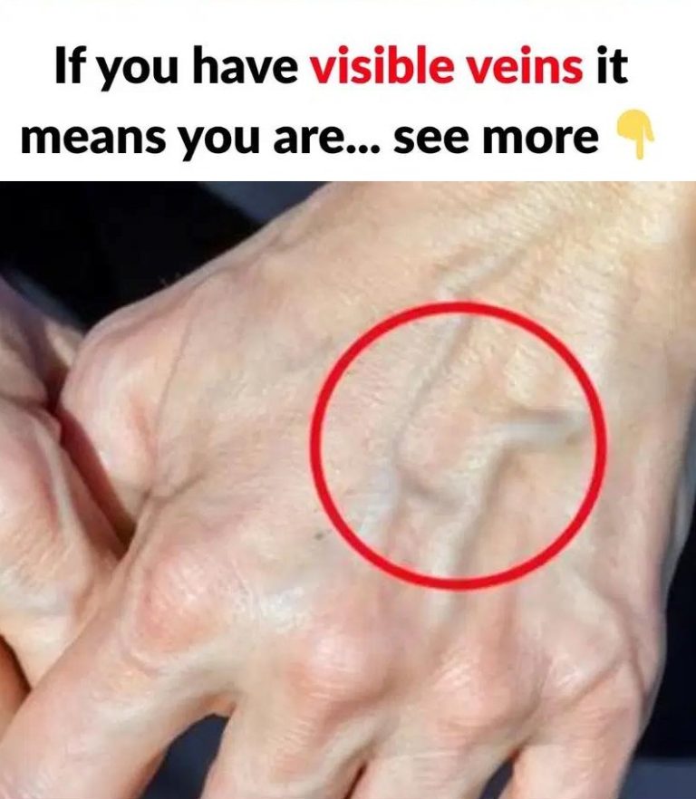 When to be concerned about Blood vessels that suddenly become visible