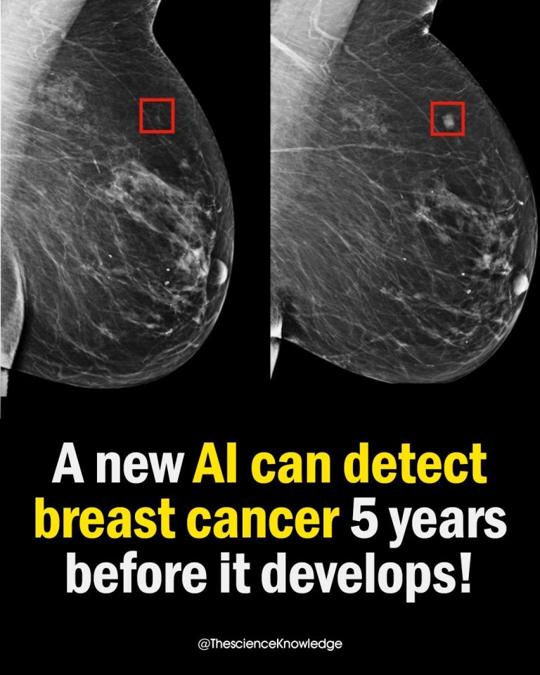 A new artificial intelligence can detect b r e a s t c a n c e r 5 years before it develops