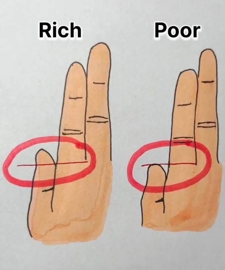 Your Fingers Could Reveal Whether You’re Rich or Poor
