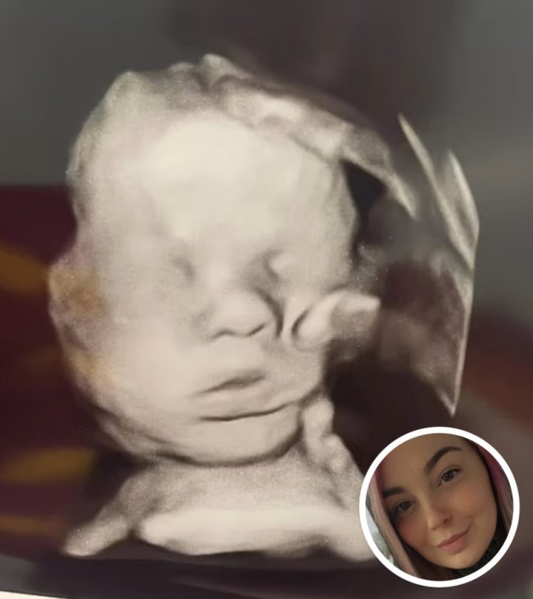 Pregnant Mom Prays For Her Babys Health, Stunned When She Looks Closer At Ultrasound