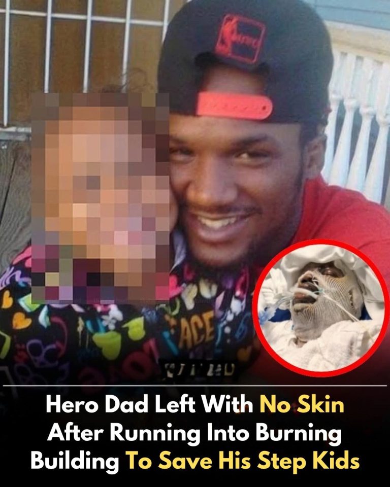 Cordale Sheffield, the Hero Dad Badly Burned Saving Stepdaughter from Fire