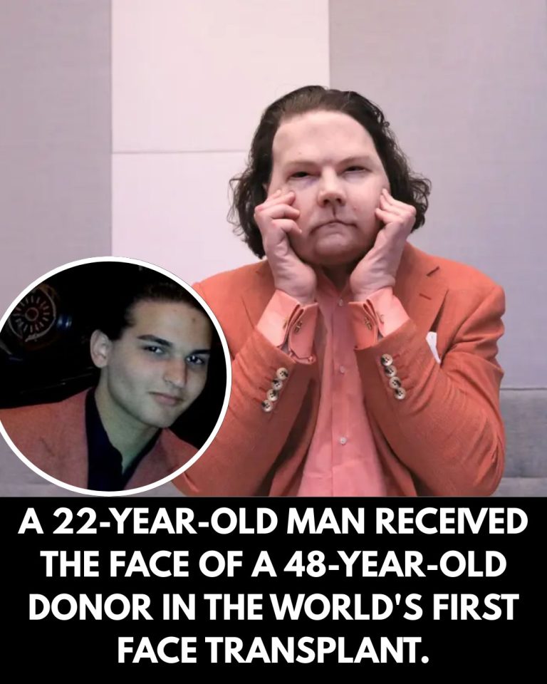 22-year-old New Jersey man gets world’s first double face, hand transplant
