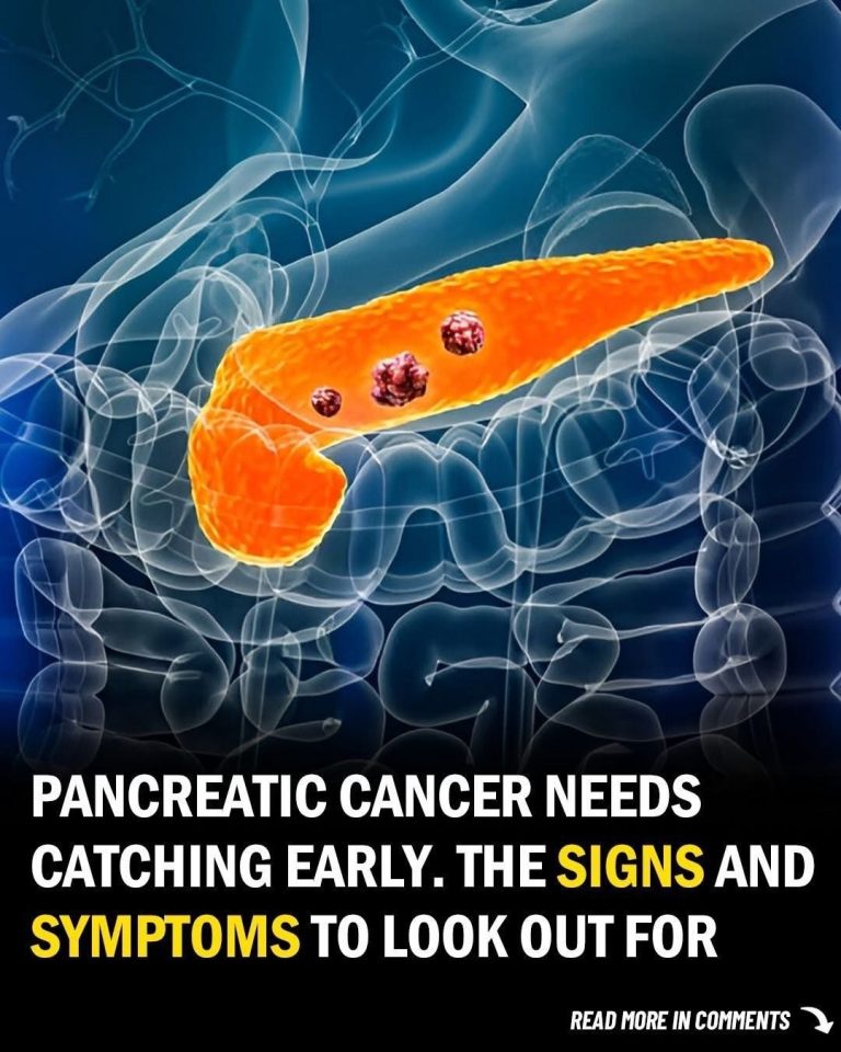 10 Signs of Pancreatic Cancer You Should Never Ignore