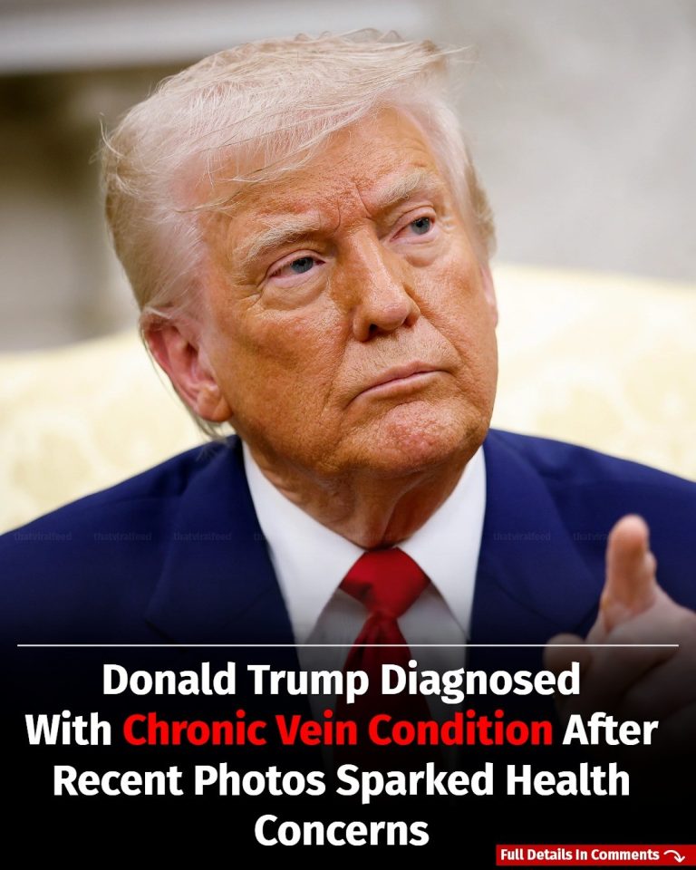 Donald Trump Diagnosed With Vein Condition After Recent Photos Sparked Health Concerns