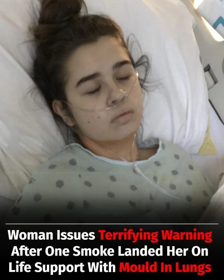 Woman Issues Terrifying Warning After One Smoke Landed Her On Life Support With Mould In Lungs