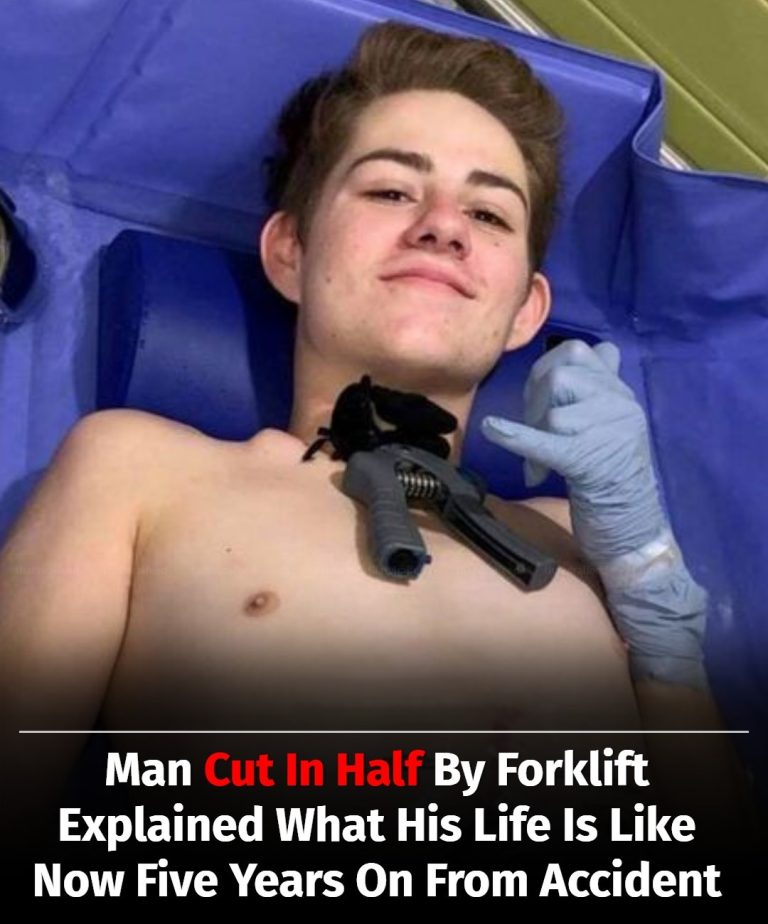 Man Crushed By Forklift Shares What Life Looks Like Five Years After Losing His Lower Body
