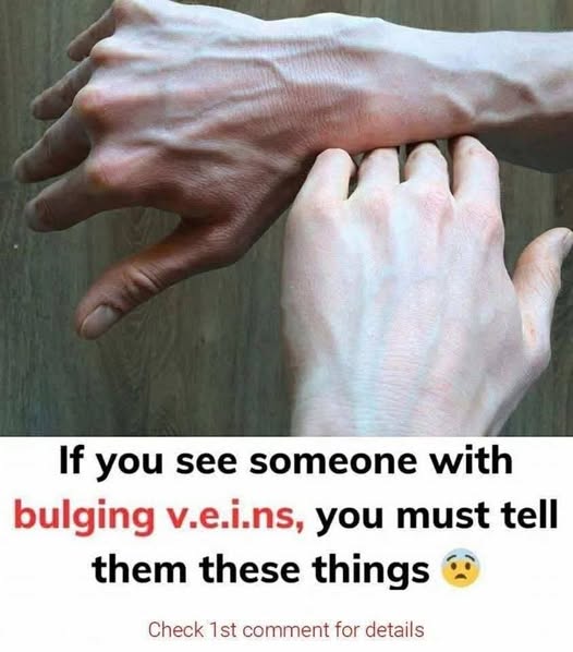 Why are your veins suddenly bulging and visible?