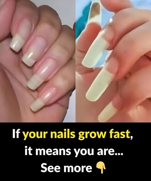 What It Really Means If Your Fingernails Grow Fast