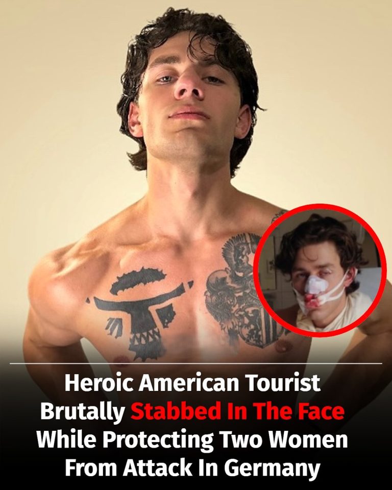 Heroic American Tourist Brutally Stabbed In The Face While Protecting Two Women From Attack In Germany