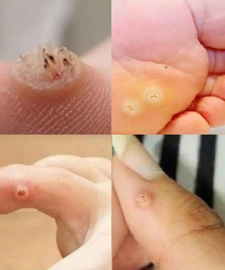 Be very careful if it comes out in your mouth, you are…