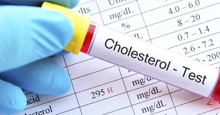 Natural Ways to Reduce Cholesterol Without Medication