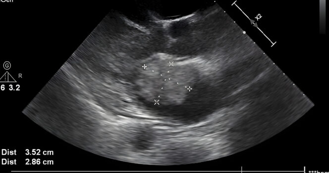 Mom spots ‘God’s hand’ cradling baby’s head in ultrasound