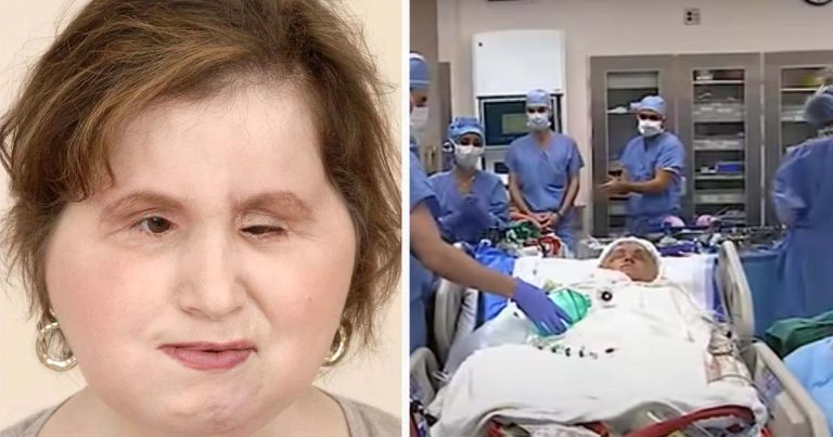 The amazing story of Katie Stubblefield: She became the youngest person to receive a face transplant