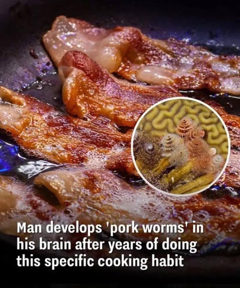Man develops ‘pork worms’ in his brain after years of doing this specific cooking habit