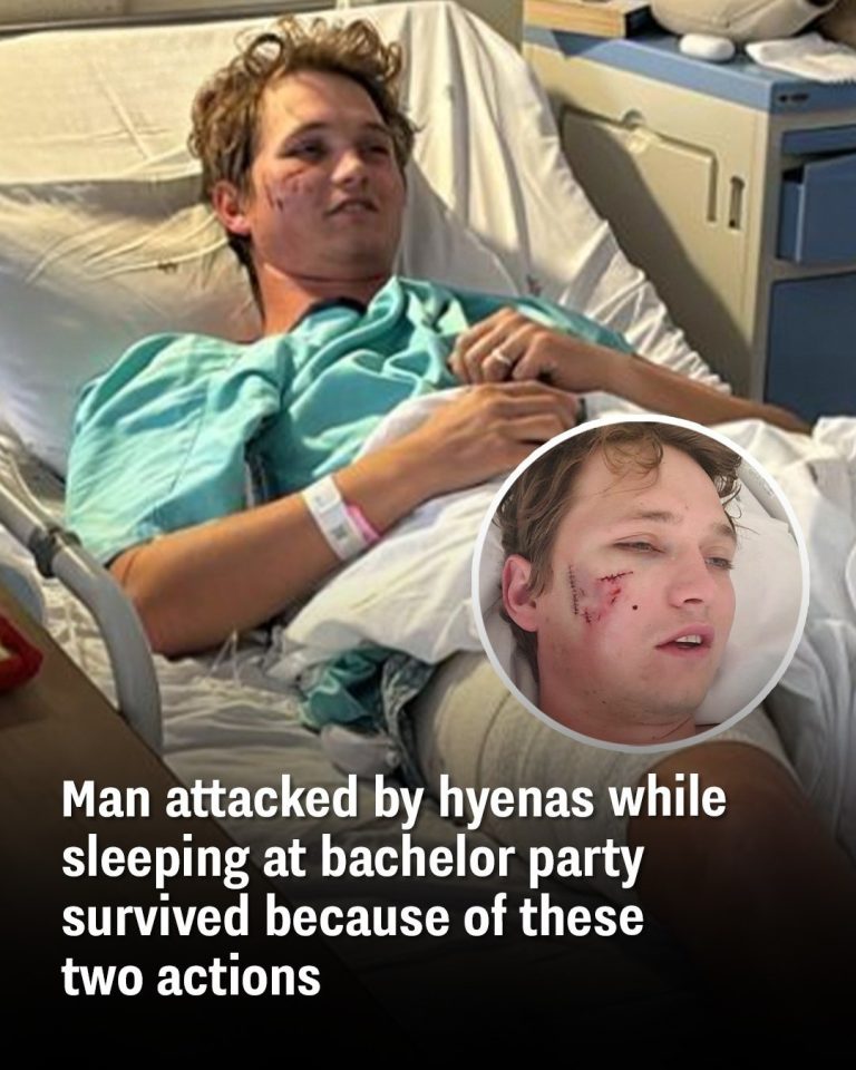 Man attacked by hyenas while sleeping at bachelor party survived because of these two actions