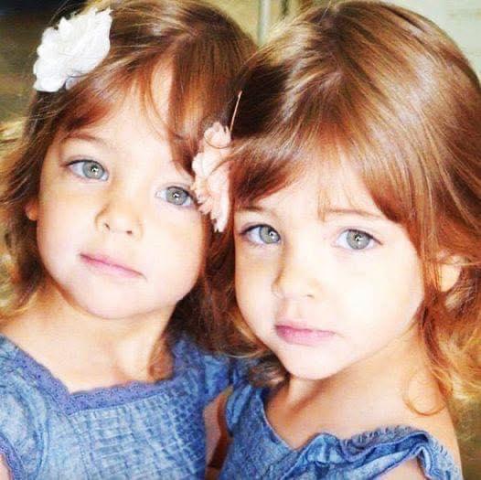 They called them the world’s most beautiful twins 10 years ago – but now look what the girls look like today