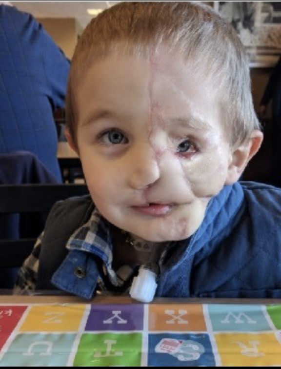 Boy, 5, survives savage attack by two dogs only to be called a ‘monster’ in public