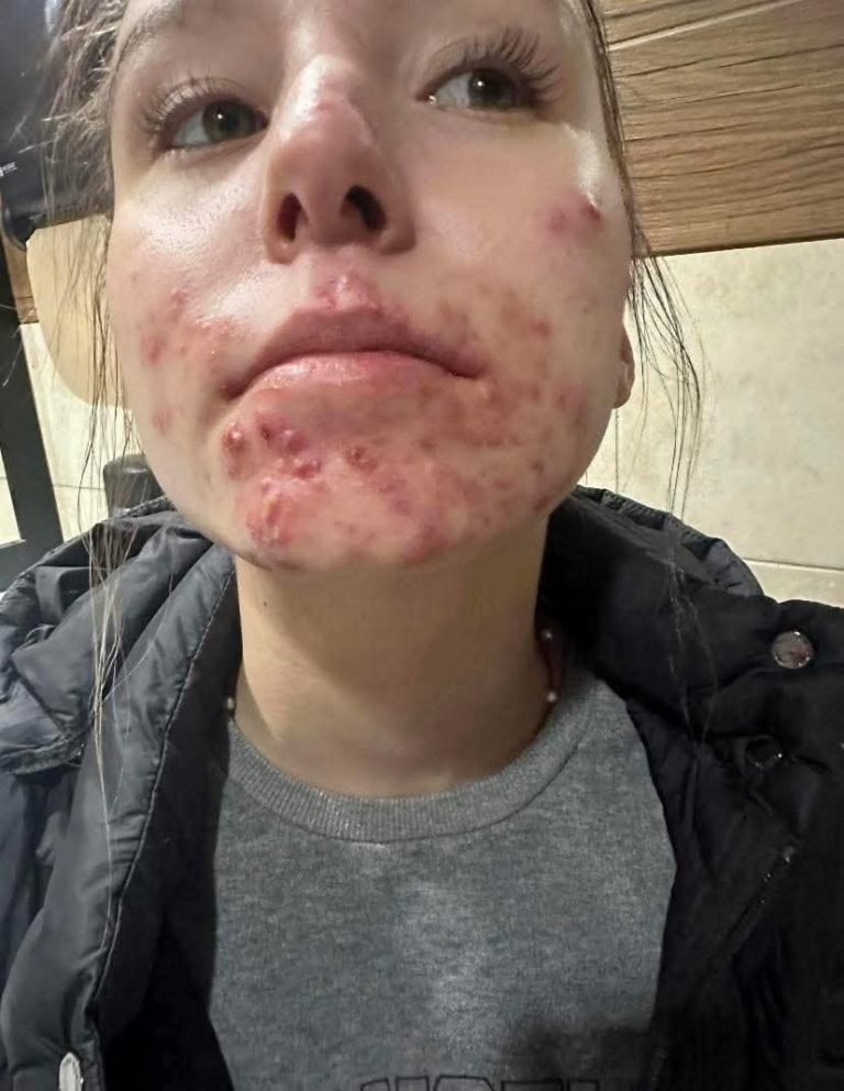 His body was itchy, he thought it was an allergy