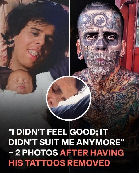 Formerly Brazil’s Most Tattooed Man Reveals Shocking Transformation After Removing Tattoos — See the After Photos