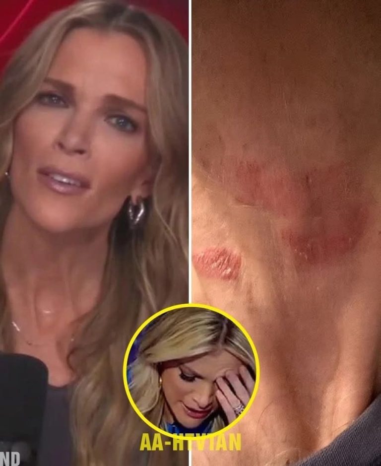 Megyn Kelly Hospitalized in Critical Condition… See more