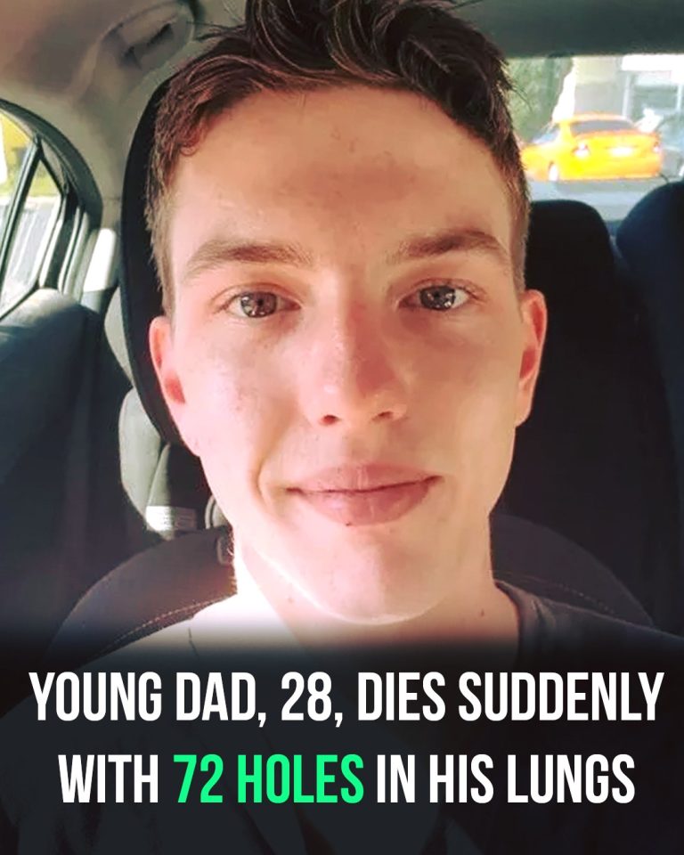 Young dad dies suddenly with 72 holes in his lungs