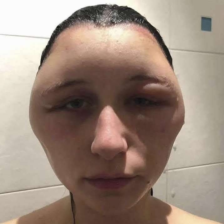 Care and Precautions When Using Hair Dyes